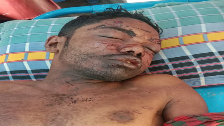 যশোর শার্শায় ককটেল বিস্ফোরণে যুবক আহত