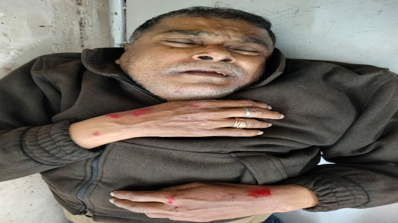 যশোরে পিকআপের ধাক্কায় চিকিৎসক আহত সড়ক অবরোধ