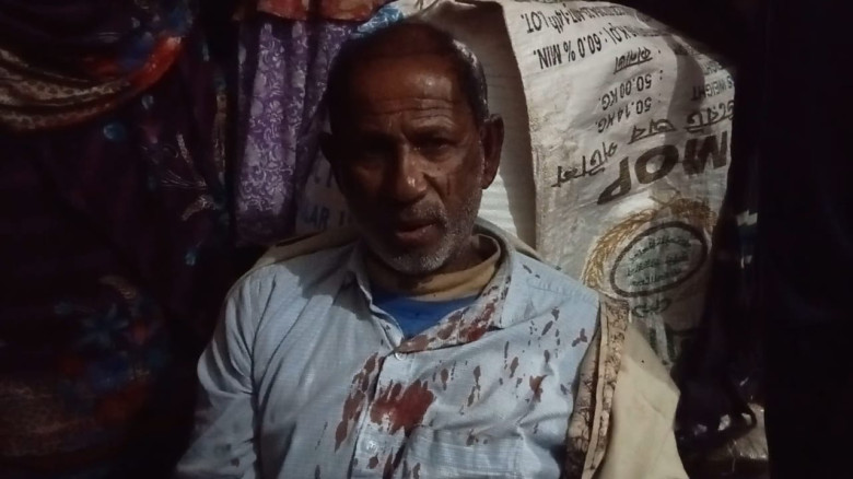 মনিরামপুরে কৃষক দম্পতিকে রক্তাক্ত করে দুর্ধর্ষ ডাকাতি