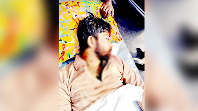 যশোরে সড়ক দুর্ঘটনায় কলেজছাত্র আহত