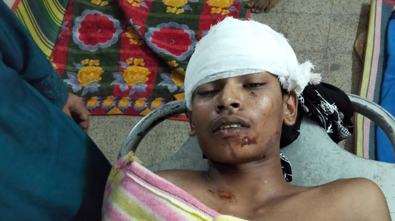 মোটরসাইকেল দুর্ঘটনায় যুবক আহত