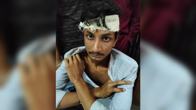 যশোর উপশহরে বাড়ির সামনে ছাত্রদল নেতার ওপর হামলা
