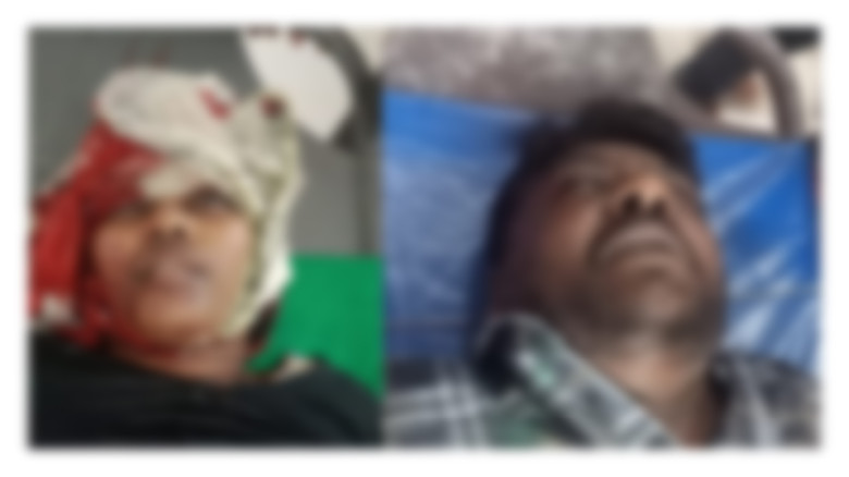 যশোরে সড়ক দুর্ঘটনায় স্বামী-স্ত্রীর  মৃত্যু...